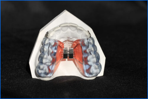 Haas avec coussin occlusal