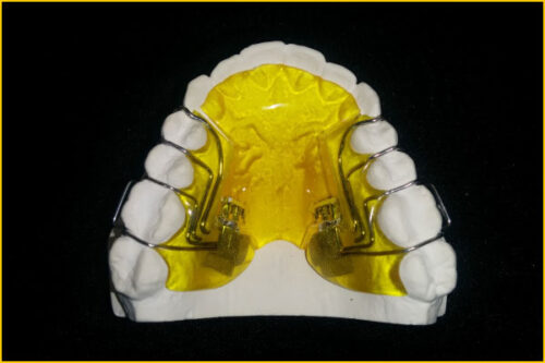 Sagittal