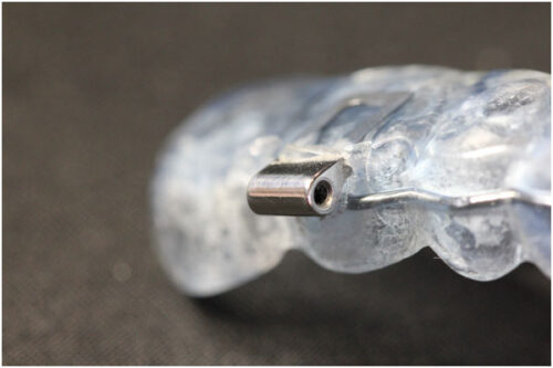 Tube pour traction extra-orale (tube de headgear)